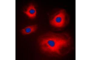 Image no. 2 for anti-Mitochondrial Ribosomal Protein L11 (MRPL11) (Center) antibody (ABIN2706593)