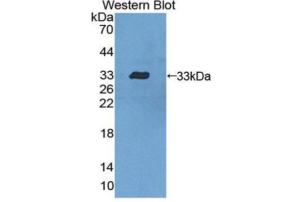 anti-Dystrobrevin, beta (DTNB) (AA 1-249) antibody