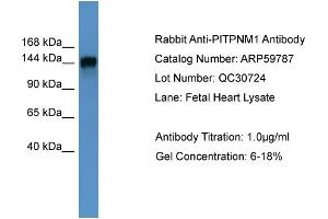 Image no. 2 for anti-Phosphatidylinositol Transfer Protein, Membrane-Associated 1 (PITPNM1) (N-Term) antibody (ABIN2788211)