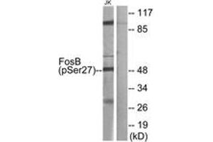 Western Blotting (WB) image for anti-FBJ Murine Osteosarcoma Viral Oncogene Homolog B (FOSB) (AA 12-61), (pSer27) antibody (ABIN1531599)