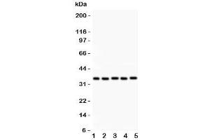 Image no. 1 for anti-Homeobox A11 (HOXA11) (AA 74-245) antibody (ABIN3031247)