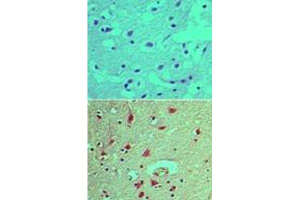 INPPL1 antibody