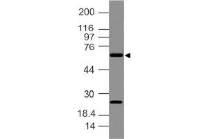 Image no. 1 for anti-delta Like Protein 3 (DLL3) (AA 62-286) antibody (ABIN5027148)