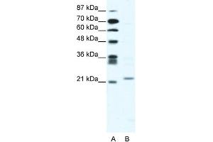 Image no. 3 for anti-Twist Homolog 1 (Drosophila) (TWIST1) (C-Term) antibody (ABIN2780347)