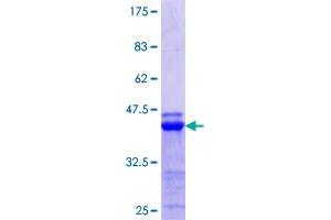 Image no. 1 for Activating Transcription Factor 6 beta (ATF6B) (AA 2-88) protein (GST tag) (ABIN1345948)