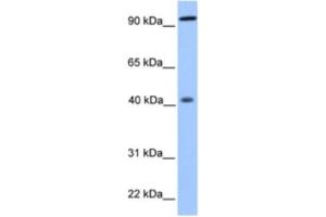 Image no. 1 for anti-Pygopus Homolog 1 (Drosophila) (PYGO1) antibody (ABIN2463350)