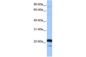 Image no. 1 for anti-serine/arginine-Rich Splicing Factor 9 (SFRS9) antibody (ABIN2462154)