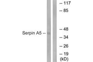 Image no. 1 for anti-serpin Peptidase Inhibitor, Clade A (Alpha-1 Antiproteinase, Antitrypsin), Member 5 (SERPINA5) (AA 260-309) antibody (ABIN1535177)
