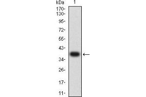 Image no. 1 for anti-Chemokine (C-C Motif) Receptor 3 (CCR3) antibody (ABIN5611257)