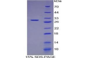 Image no. 1 for Chordin (CHRD) protein (ABIN3008778)