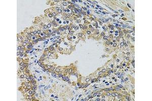 Immunohistochemistry of paraffin-embedded Human prostate using Gm13125 Polyclonal Antibody at dilution of 1:100 (40x lens).