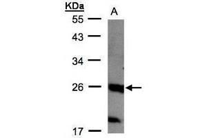 Image no. 1 for anti-Nucleoside-Triphosphatase, Cancer-Related (NTPCR) (C-Term) antibody (ABIN2856592)