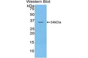 Image no. 1 for anti-NIMA (Never in Mitosis Gene A)-Related Kinase 2 (NEK2) (AA 137-400) antibody (ABIN1859978)
