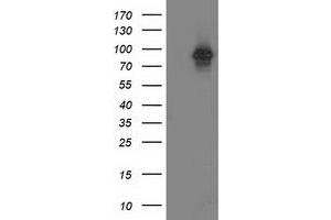 Image no. 1 for anti-Protein Kinase C, epsilon (PRKCE) antibody (ABIN1500232)