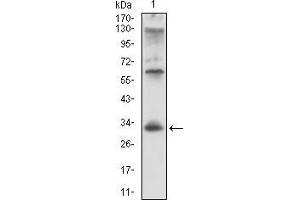 Image no. 4 for anti-HLA-DR-gamma (CD74) (AA 1-106) antibody (ABIN1724870)