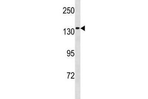 Image no. 1 for anti-Minichromosome Maintenance Deficient 9 (MCM9) (AA 316-345) antibody (ABIN3028841)