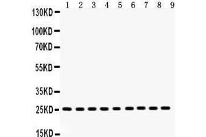 Image no. 3 for anti-Peroxiredoxin 3 (PRDX3) (AA 110-256) antibody (ABIN3043904)