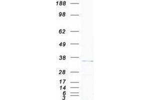 Image no. 1 for VAMP (Vesicle-Associated Membrane Protein)-Associated Protein A, 33kDa (VAPA) (Transcript Variant 2) protein (Myc-DYKDDDDK Tag) (ABIN2735169)