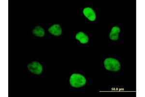Image no. 3 for anti-Minichromosome Maintenance Deficient 4 (MCM4) (AA 1-863) antibody (ABIN517776)
