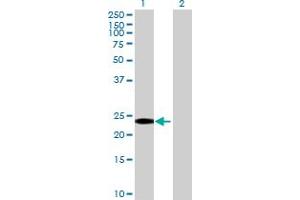 RGS8 antibody  (AA 1-198)