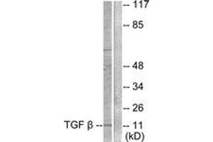 Image no. 1 for anti-Transforming Growth Factor, beta 3 (TGFB3) (AA 261-310) antibody (ABIN1533414)