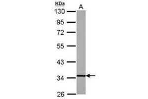 Image no. 2 for anti-2,4-Dienoyl CoA Reductase 1, Mitochondrial (DECR1) (AA 20-276) antibody (ABIN1497807)