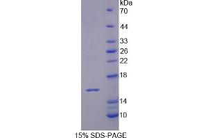 Image no. 1 for Interleukin 16 (IL16) (AA 508-627) protein (His tag) (ABIN6236560)