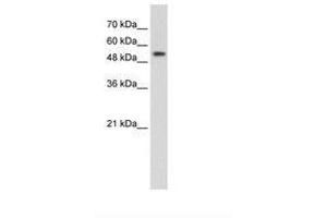 Image no. 2 for anti-Pre-mRNA Processing Factor 19 (PRPF19) (AA 151-200) antibody (ABIN203527)