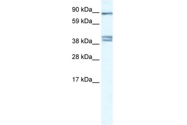 anti-Chloride Channel Kb (CLCNKB) (C-Term) antibody
