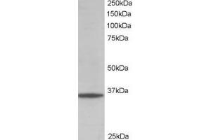 Image no. 12 for anti-Glyceraldehyde-3-Phosphate Dehydrogenase (GAPDH) (C-Term) antibody (ABIN185240)