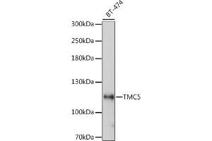 Tmc5 antibody  (AA 676-760)