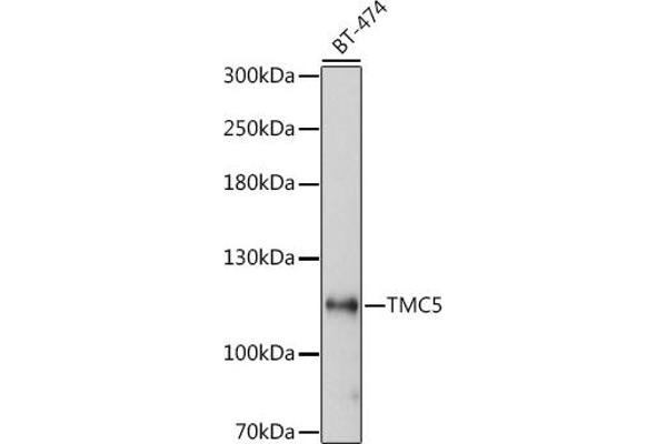 Tmc5 antibody  (AA 676-760)