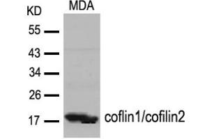Image no. 2 for anti-Cofilin 1 (CFL1) (Tyr88) antibody (ABIN319381)