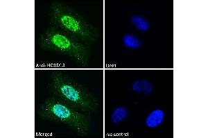Image no. 1 for anti-Homeobox D13 (HOXD13) (Internal Region) antibody (ABIN570834)