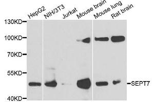 Image no. 1 for anti-Septin 7 (SEPT7) antibody (ABIN6147558)