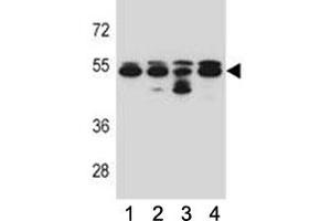 Image no. 2 for anti-Tubulin, beta 8 (TUBB8) (AA 34-62) antibody (ABIN3029772)