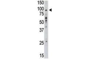 Image no. 3 for anti-Toll-Like Receptor 6 (TLR6) (AA 393-423) antibody (ABIN3029174)