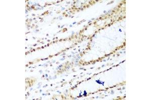 Image no. 4 for anti-Histone Deacetylase 1 (HDAC1) (N-Term) antibody (ABIN3020754)