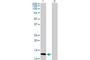 Image no. 1 for anti-SH2 Domain Containing 1A (SH2D1A) (AA 1-128) antibody (ABIN517591)