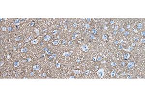 Immunohistochemistry of paraffin-embedded Human brain tissue using SNCB Polyclonal Antibody at dilution of 1:45(x200)