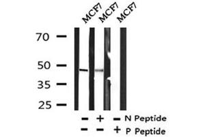 Image no. 1 for anti-DEP Domain Containing mTOR-Interacting Protein (DEPTOR) (pSer244) antibody (ABIN6267834)