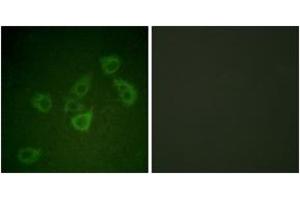 Immunofluorescence analysis of HuvEc cells, using Caspase 6 (Phospho-Ser257) Antibody.