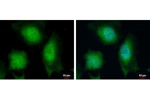 ICC/IF Image Calcipressin 1 antibody detects Calcipressin 1 protein at cytoplasm and nucleus by immunofluorescent analysis.