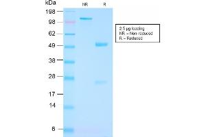 Image no. 1 for anti-Folate Hydrolase (Prostate-Specific Membrane Antigen) 1 (FOLH1) (AA 232-433) antibody (ABIN6939428)