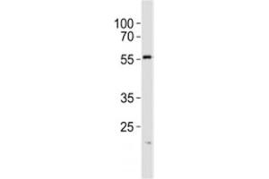 Image no. 5 for anti-Sphingosine Kinase 1 (SPHK1) (AA 1-30) antibody (ABIN3032709)
