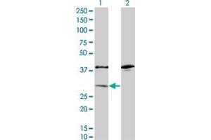 Image no. 1 for anti-Sulfotransferase Family, Cytosolic, 1A, Phenol-Preferring, Member 1 (SULT1A1) (AA 1-295) antibody (ABIN520604)