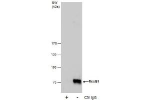 Image no. 2 for anti-RecQ Protein-Like (DNA Helicase Q1-Like) (RECQL) (N-Term) antibody (ABIN2857056)