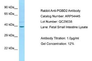 Image no. 1 for anti-PiggyBac Transposable Element Derived 2 (PGBD2) (Middle Region) antibody (ABIN2785716)