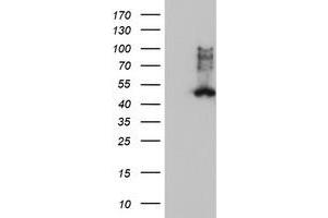 Image no. 2 for anti-Farnesyl-Diphosphate Farnesyltransferase 1 (FDFT1) antibody (ABIN1498243)