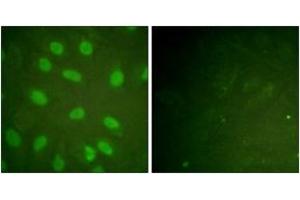Immunofluorescence analysis of HeLa cells, using Ku80 (Phospho-Thr714) Antibody.